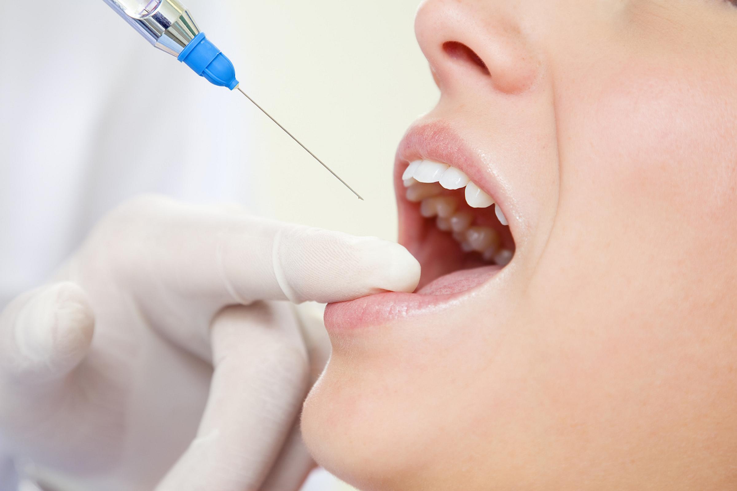open mouth and dentist syringe giving local anesthetic to patient